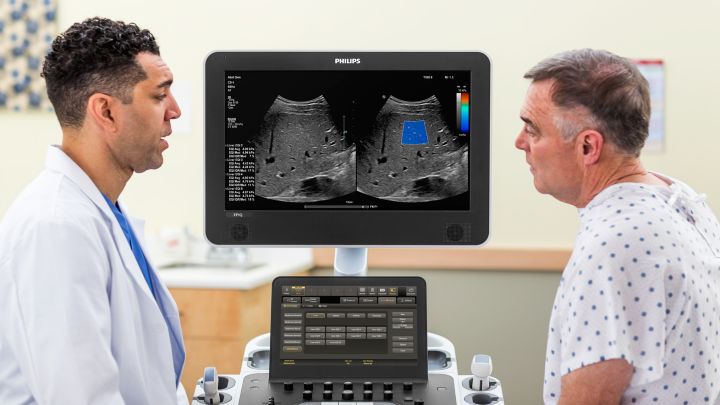 Simplify liver disease assessment with shear wave elastography