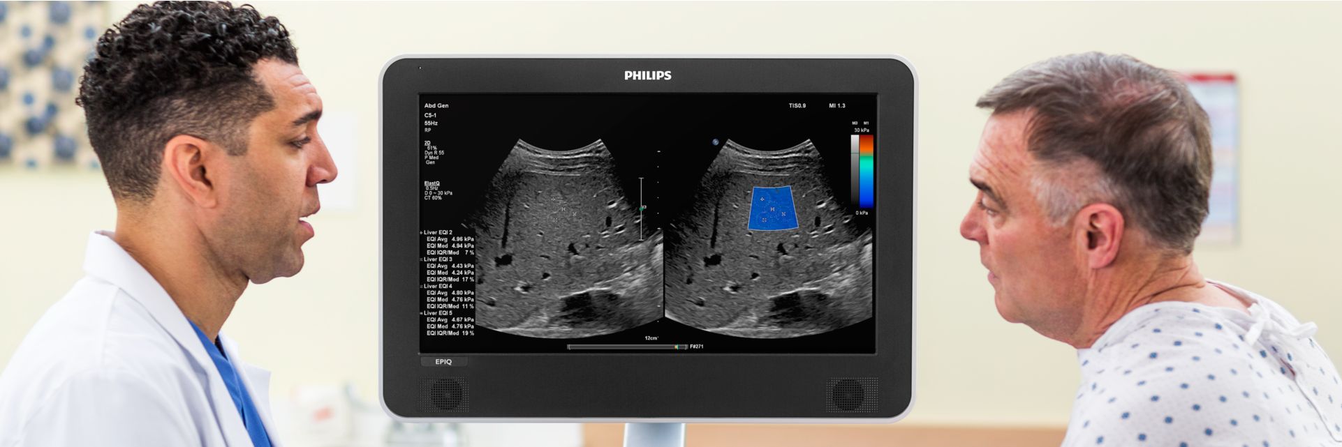 Ultrasound shear wave liver consultation between doctor and patient