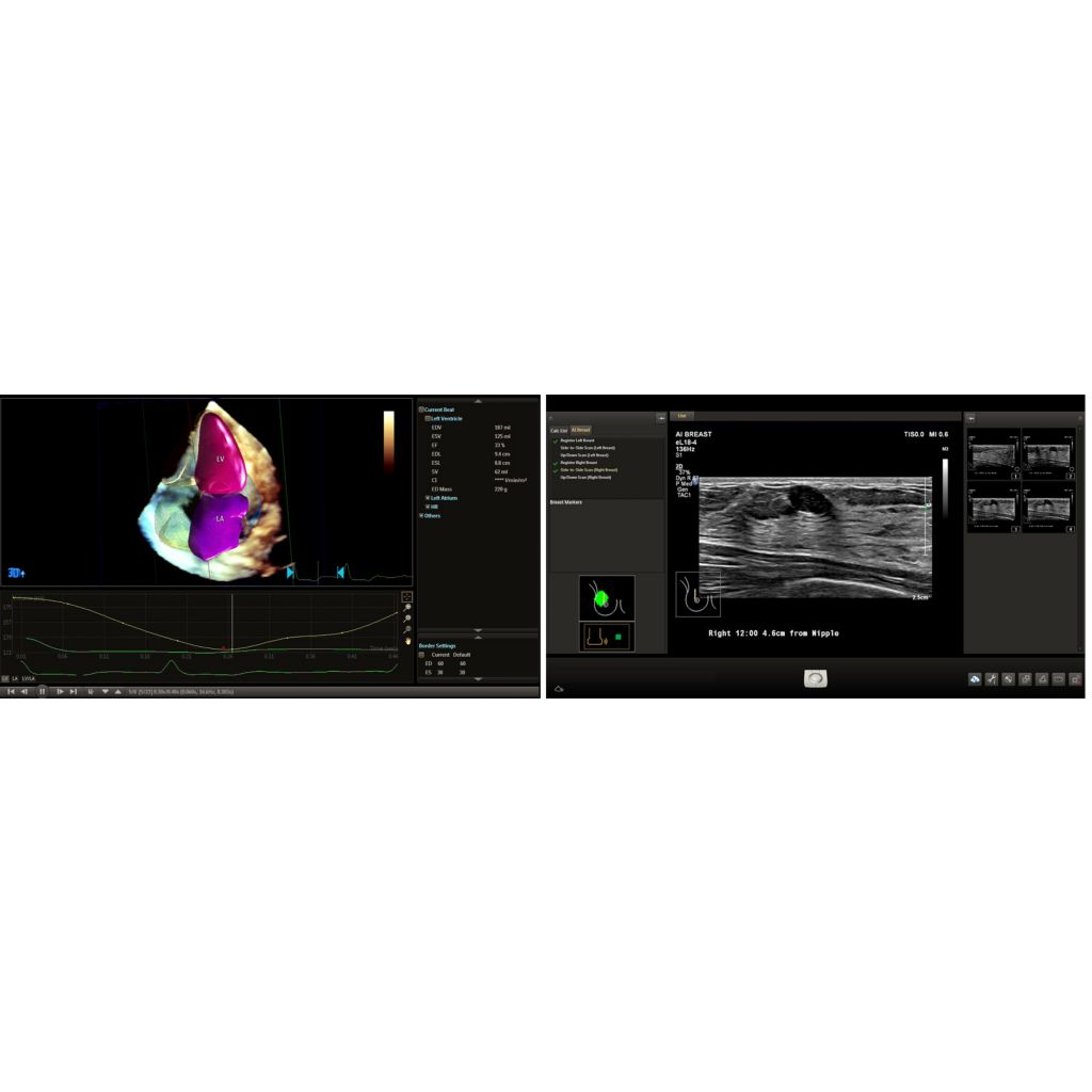 Image Fusion and Navigation-Easy to use modality fusion and interventional guidance