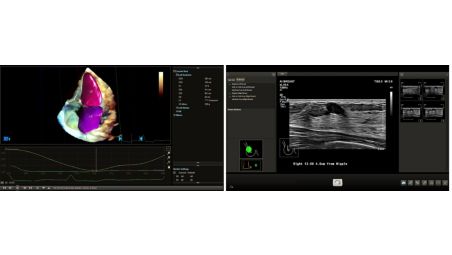 Fusion d’images et navigation – Fusion multi-modalités et guidage interventionnel faciles à utiliser