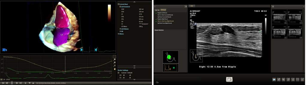 Image Fusion and Navigation-Easy to use modality fusion and interventional guidance