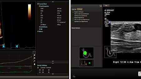 Image Fusion and Navigation-Easy to use modality fusion and interventional guidance