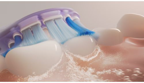 Dokumenteret Sonicare-teknologi