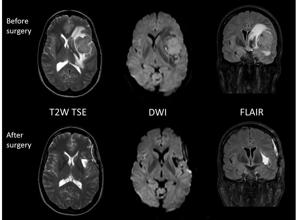 SmartExam Brain, Achieva 3.0T, Courtesy: Clinique Generale Beaulieu, Geneva, Zwitserland