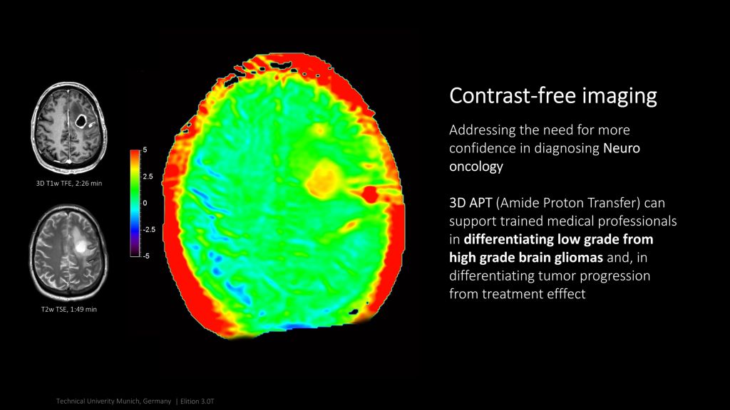 Contrast-free imaging with Elition X

