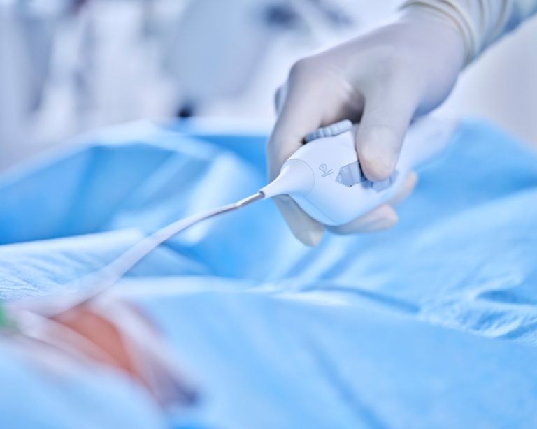 ICE Catheter