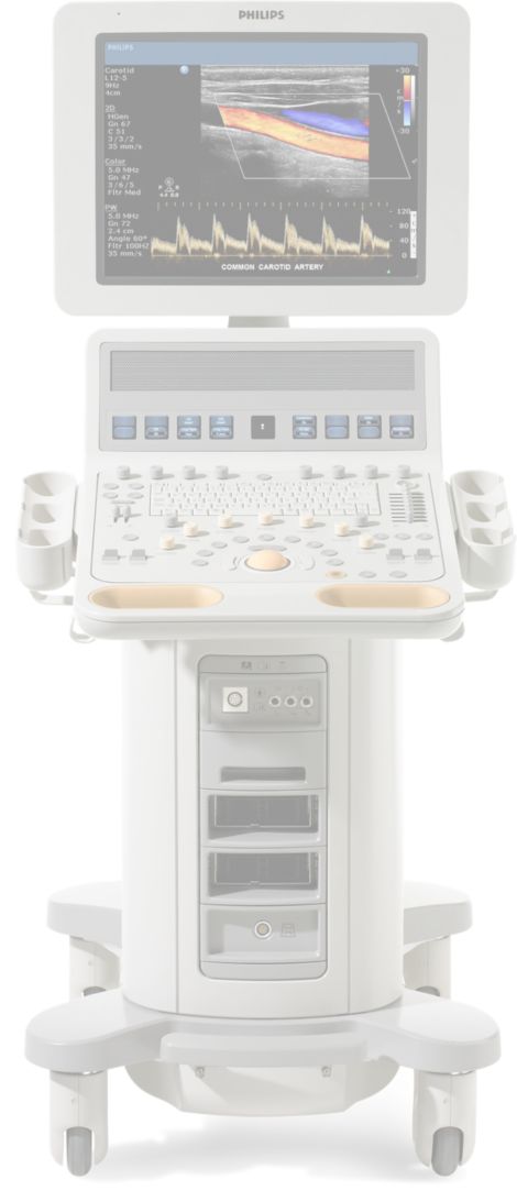 HD15 Ultrasound system