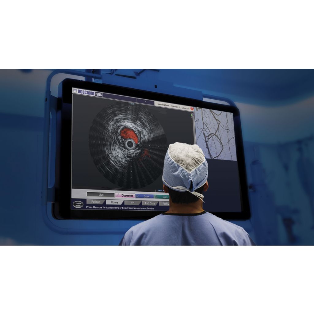 The only IVUS-guided re-entry device
