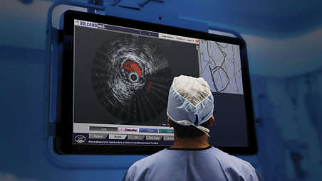 The only IVUS-guided re-entry device