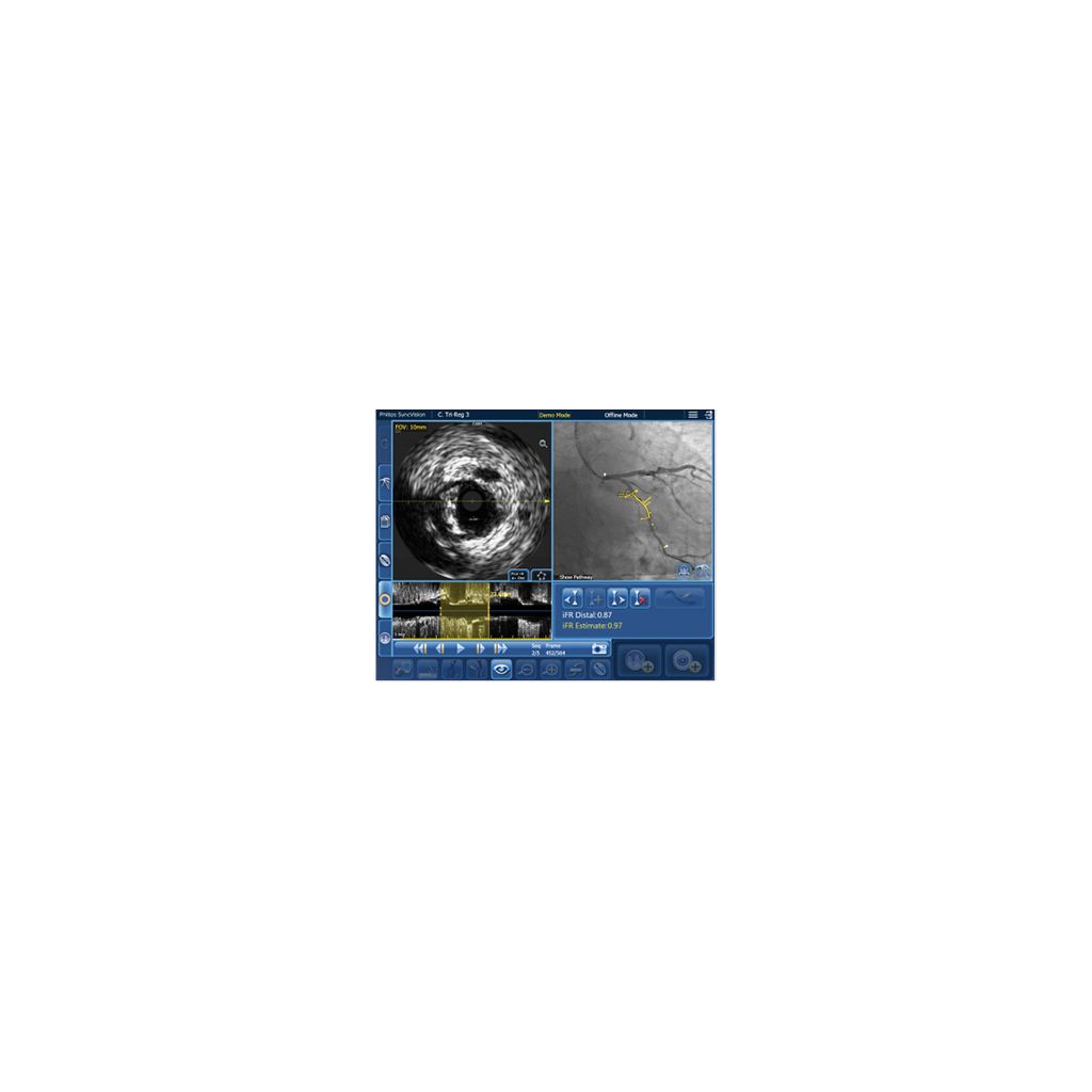 Addresses imaging challenges