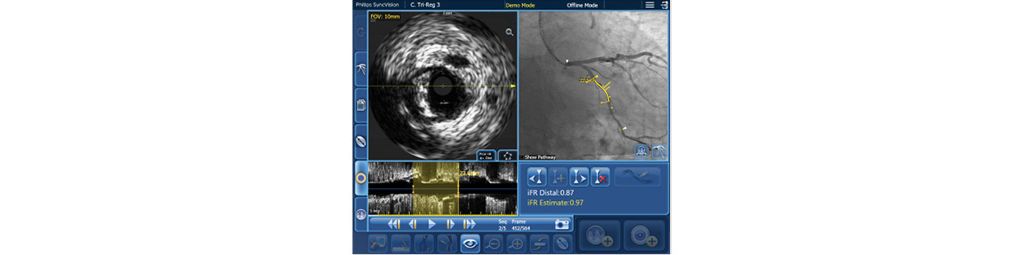 Addresses imaging challenges