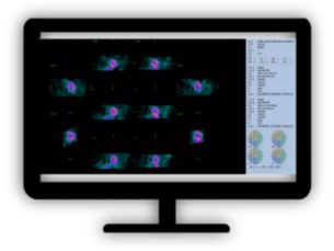 NM Cedars-Sinai Cardiac Suite  Advanced cardiac quantification