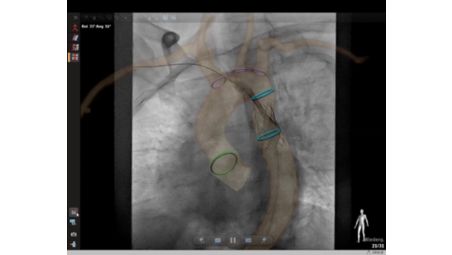 Superb image quality