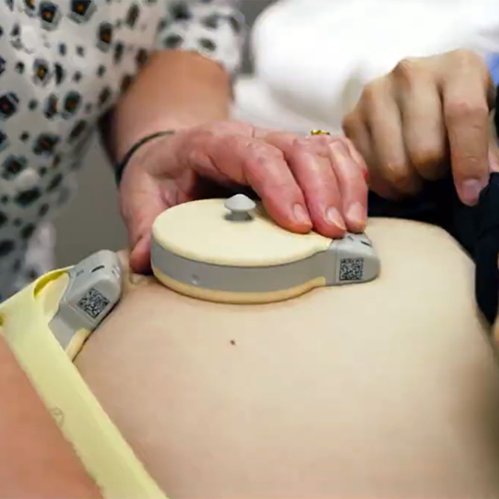 transducers being placed on pregnant belly