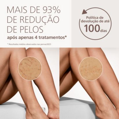 Philips Lumea IPL 9900 Pro