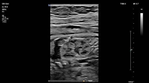 Kidney eL18-4
