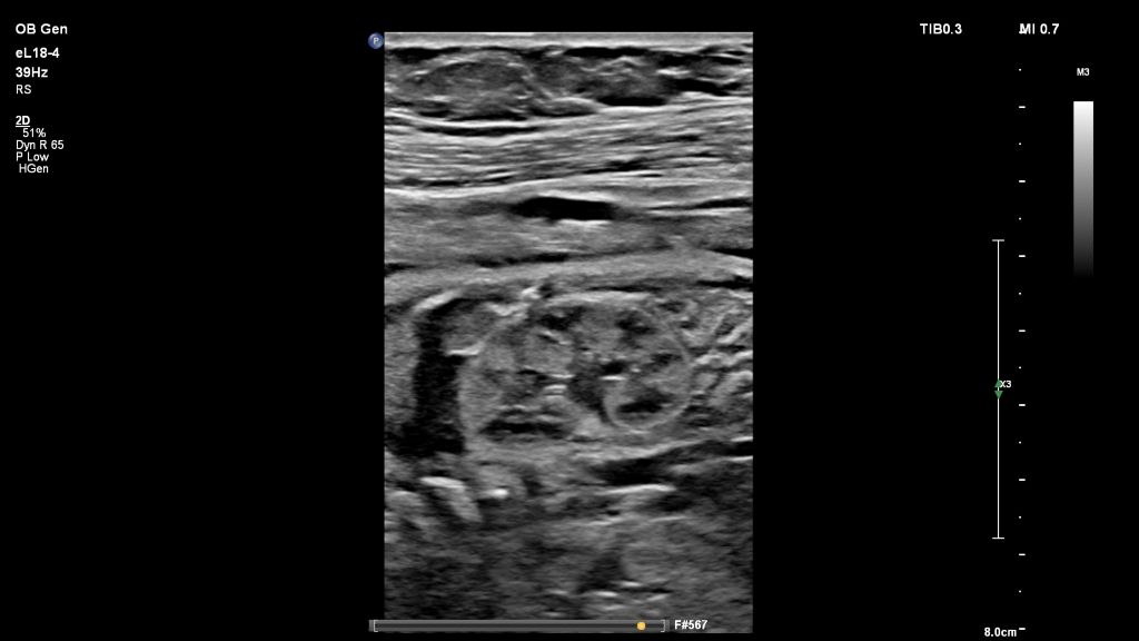 Kidney eL18-4