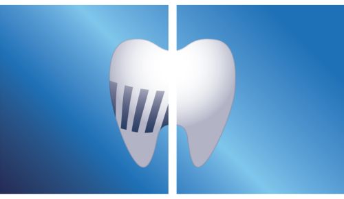 Up to 99.9% plaque removal***