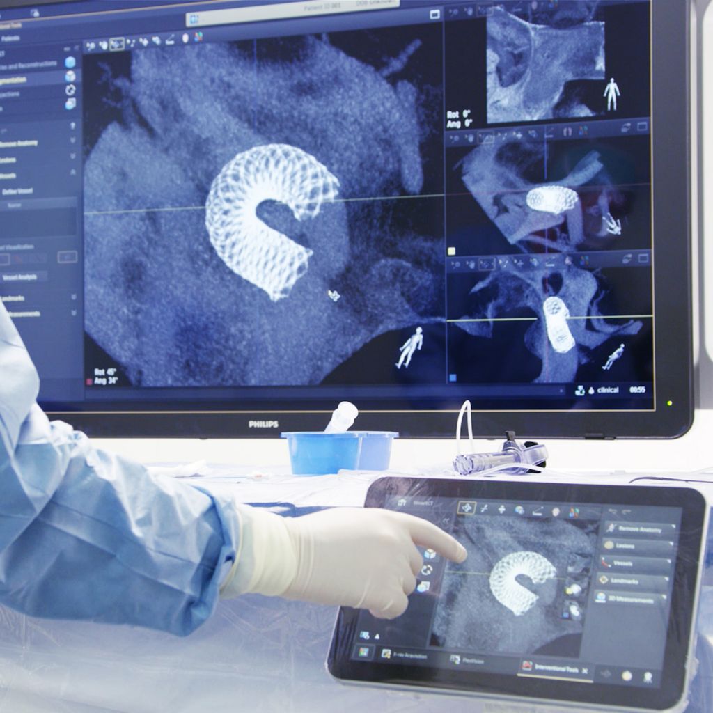 SmartCT Vaso report