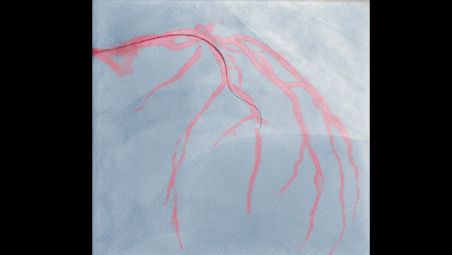 Gu&iacute;a de im&aacute;genes en vivo detallada