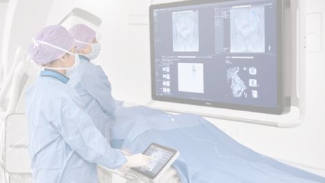 SmartCT Roadmap Live 3D image guidance tool