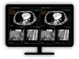 CT Spectral Magic Glass on PACS​ Review and analyze multiple layers of spectral data at once