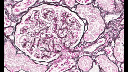 Clinical image digital pathology