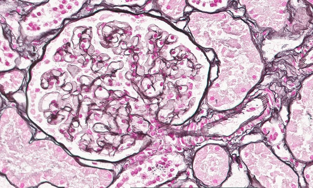 Clinical image digital pathology