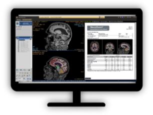 MR NeuroQuant Automated brain image analysis