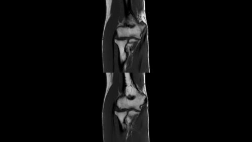 T1w - Elbow