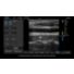 InnoSight training: Color and power doppler