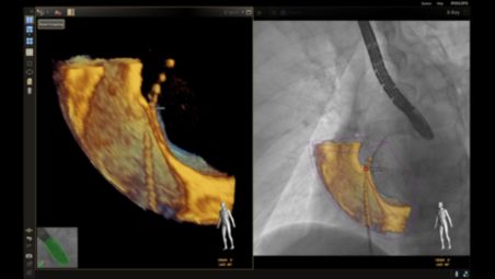 Additional reference point through TOE cone