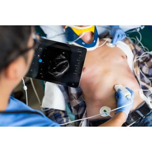 Enlarged view of picture