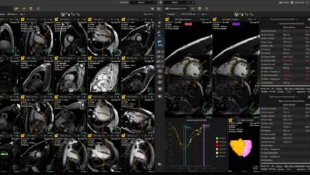 An enhanced cardiac MR reading experience