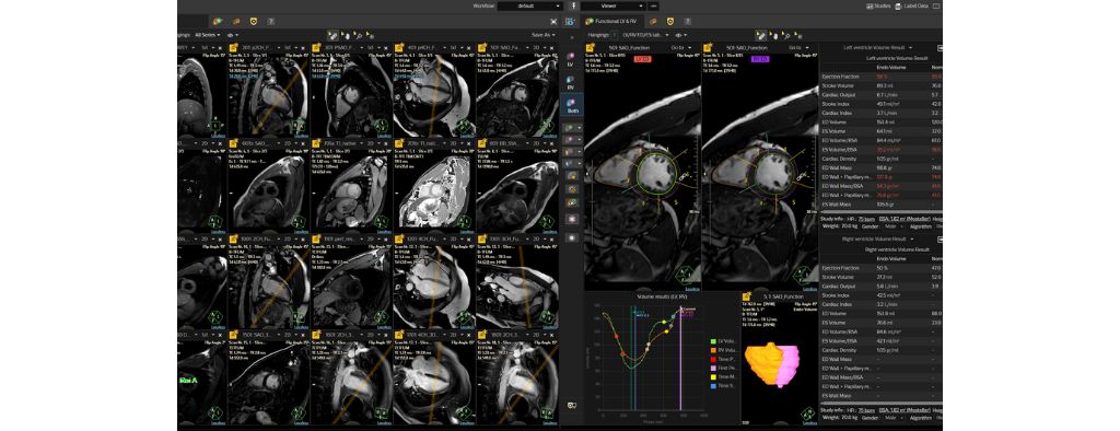MR Cardiac Suite