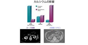 その２：仮想単色X線画像について