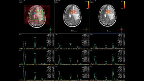 Spectroscopy Imaging