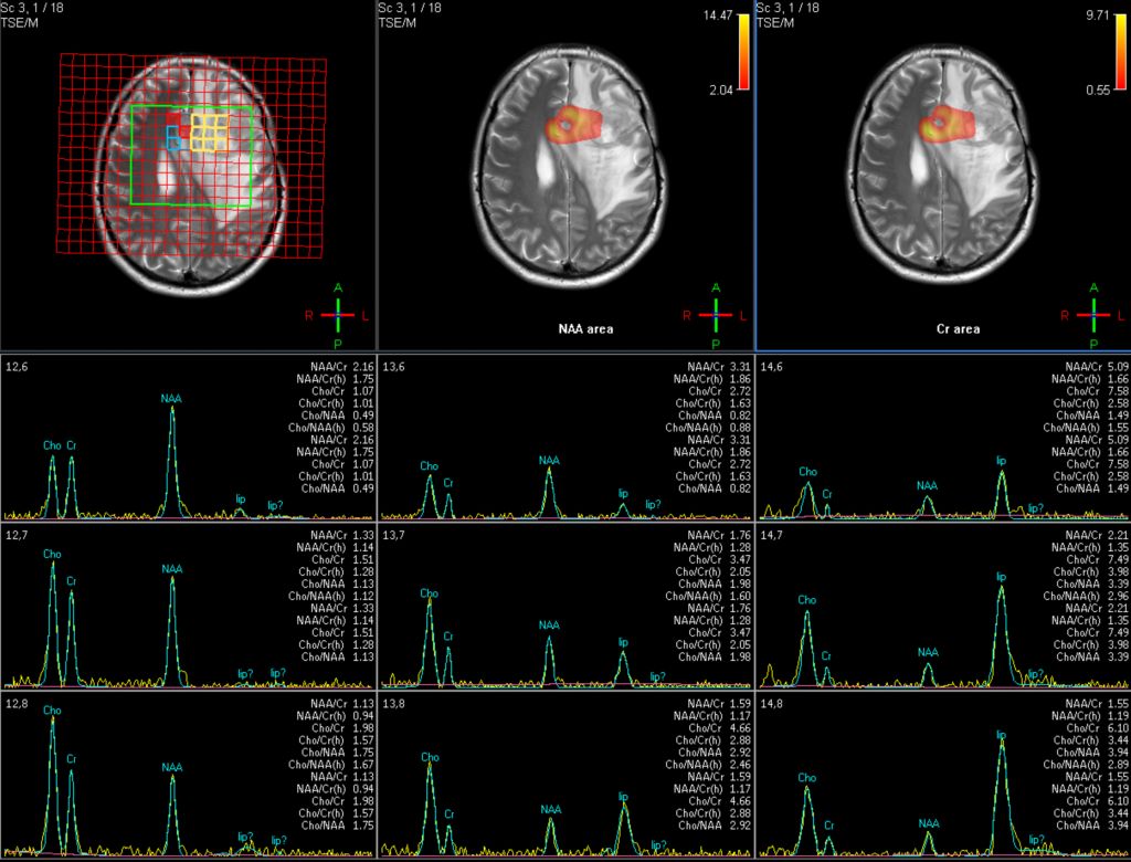 Spectroscopy Imaging