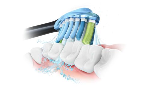 Advanced Sonicare technology for a powerful yet gentle clean