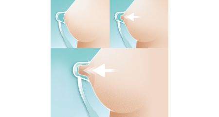 Order Supple Cups: a treatment for inverted nipples and flat nipples- works  better than the Avent Niplette