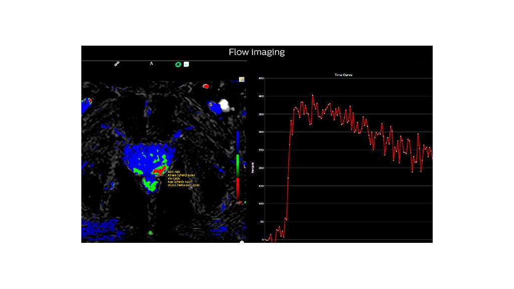 Dr Steiner Article MR Flow imaging