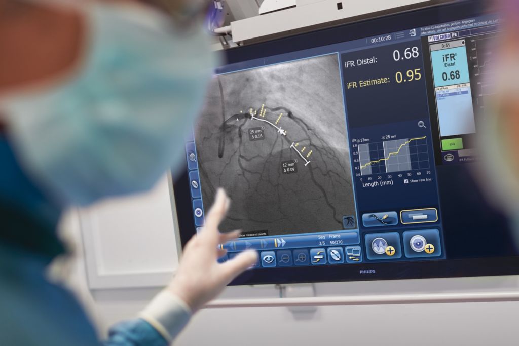 Découvrez comment le processus de travail ACT PCI guide la prise de décision clinique