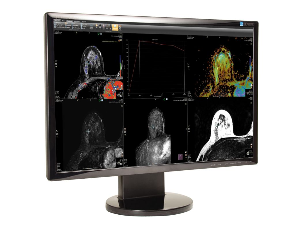 DynaCAD Breast   Advanced post-processing imaging system for Breast MRI analysis