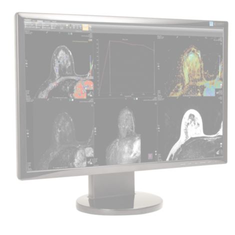 DynaCAD Breast Visualización avanzada para el análisis de IRM de mama