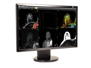 DynaCAD Breast Visualização avançada para análise de imagens de ressonância magnética da mama