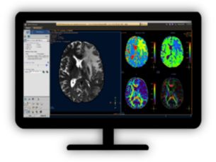 MR Diffusion Analyze diffusion and anisotropic properties of tissue