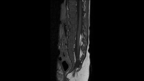 Sagittal T1w (5kg)