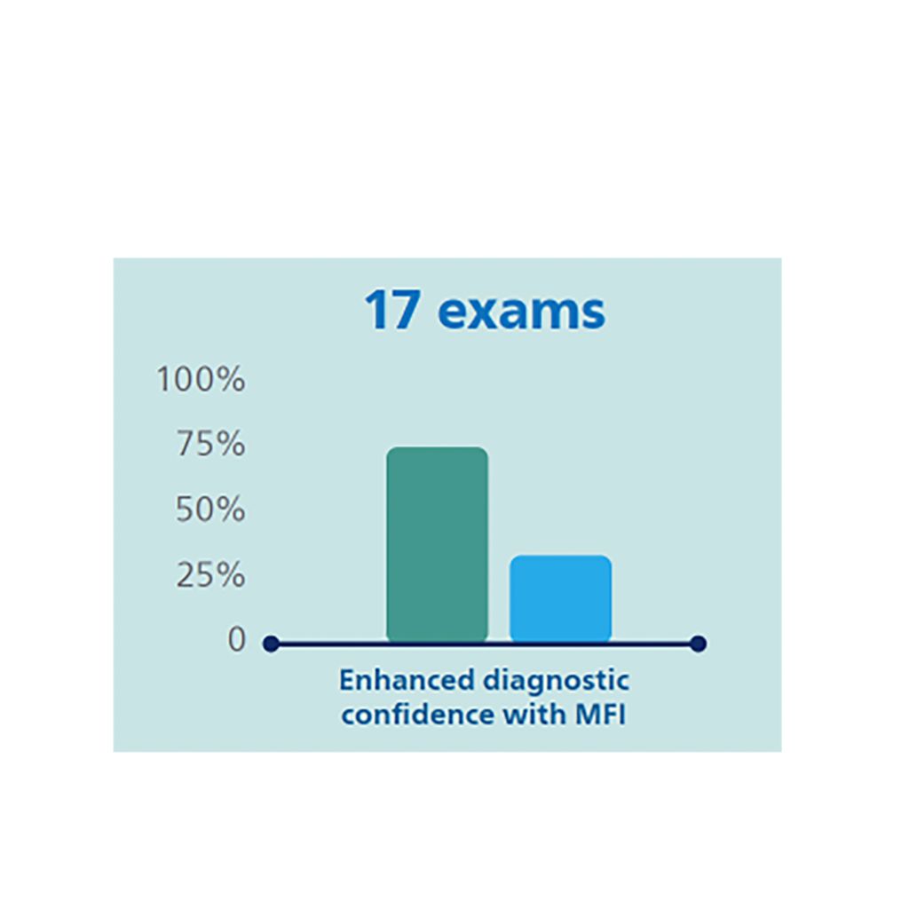 Diagnostic confidence with MFI