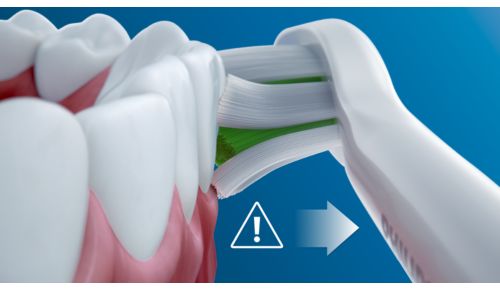 Avisa cuando te cepillas los dientes con demasiada fuerza