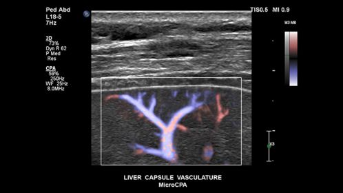 Liver capsule vasculature MicroCPA